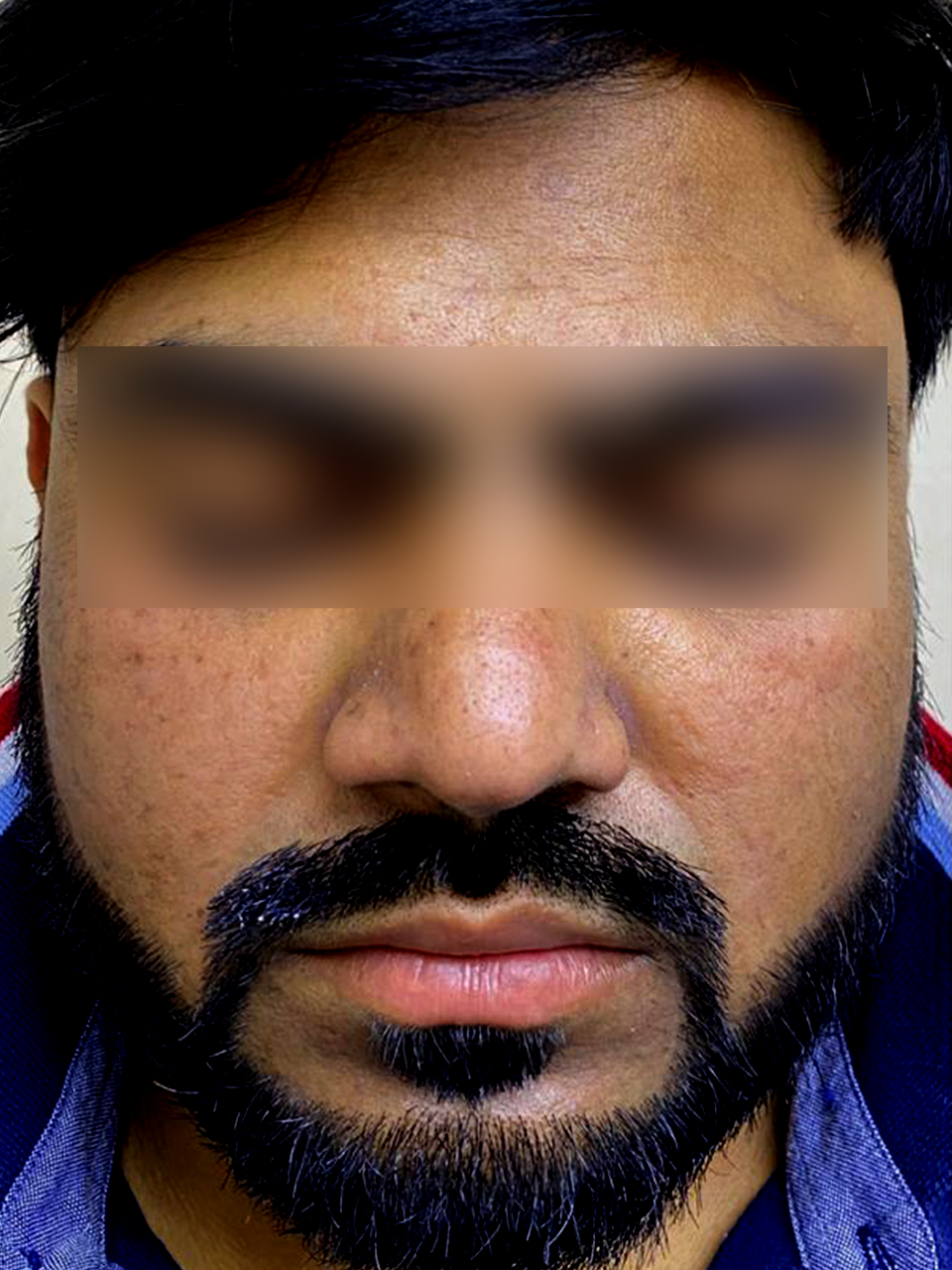After treatment
